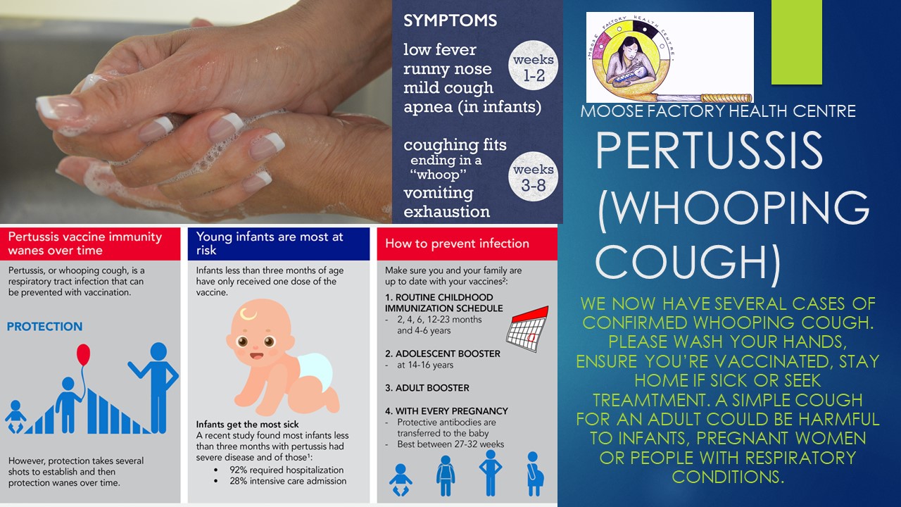 Infographic describing pertussis (whooping cough)